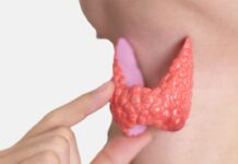 Щитовидная железа. Как лечить узлы в щитовидке?