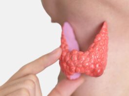 Щитовидная железа. Как лечить узлы в щитовидке?