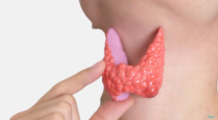 Щитовидная железа. Как лечить узлы в щитовидке?