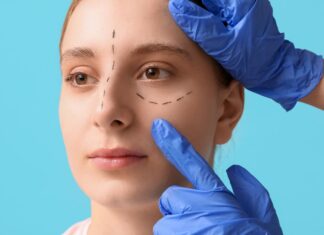 Лифтинг лица при птозе