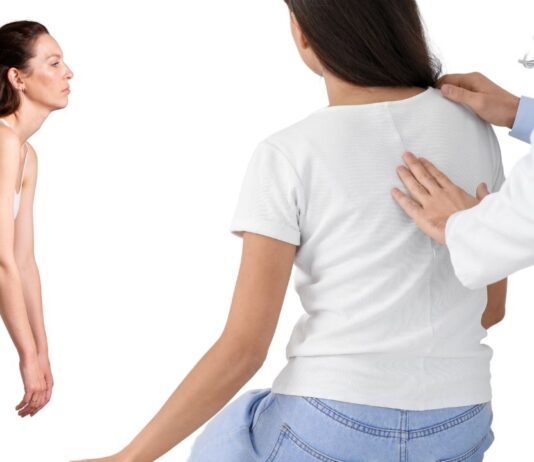 Как исправить осанку осанку, упражнения для позвоночника