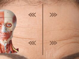 Метопический шов: упражнения от морщин на лбу